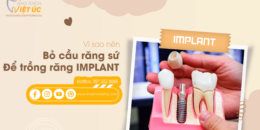 Implant là gì? tại sao nên bỏ cầu răng sứ để trồng răng Implant