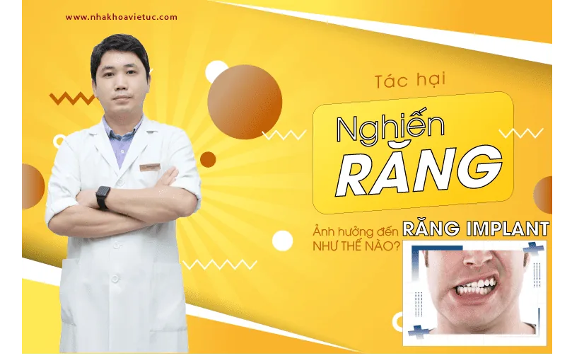 tác hại nghiến răng ảnh hưởng dén răng implant như thế nào