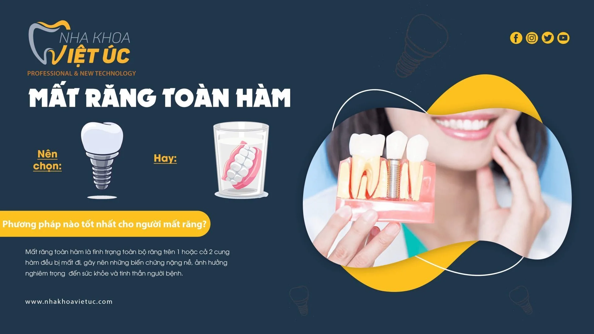 MẤT RĂNG TOÀN HÀM NÊN TRỒNG IMPLANT HAY HÀM THÁO LẮP?