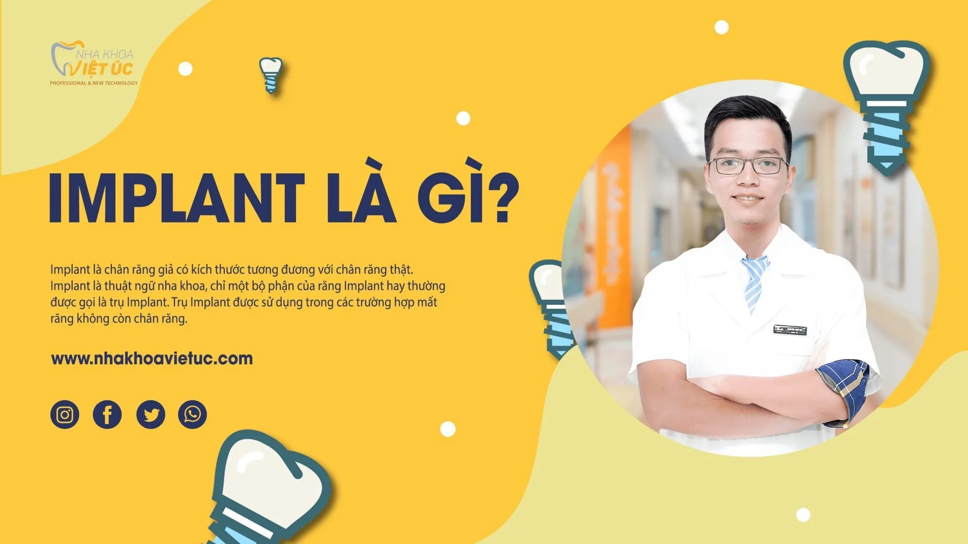 iMPLANT LÀ GÌ
