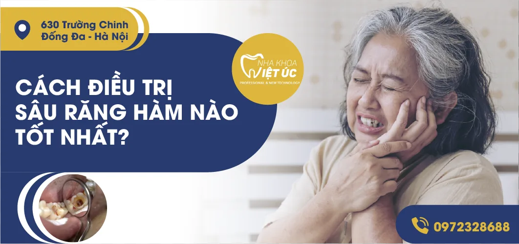 điều trị sâu răng tại nha khoa việt úc