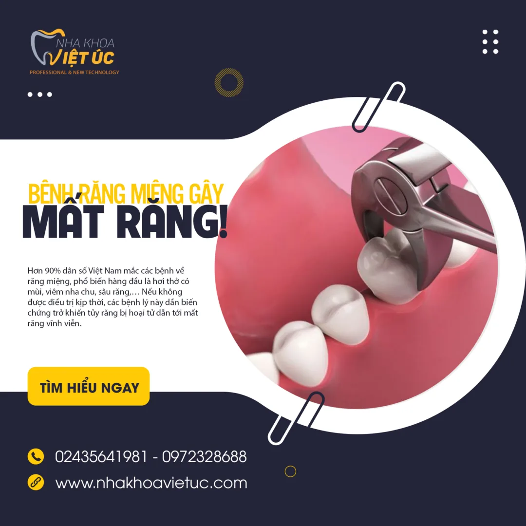bệnh răng miệng gây mất răng